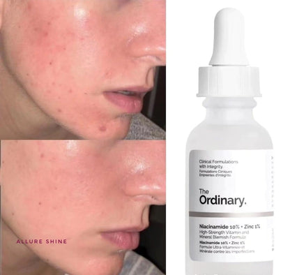Niacinamide 10% + Zinc 1%